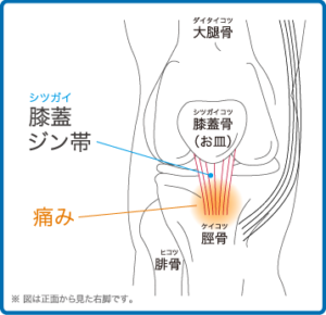 神戸市須磨区はくの接骨院　膝の痛み